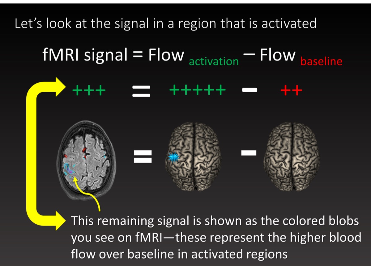 fmri contrast